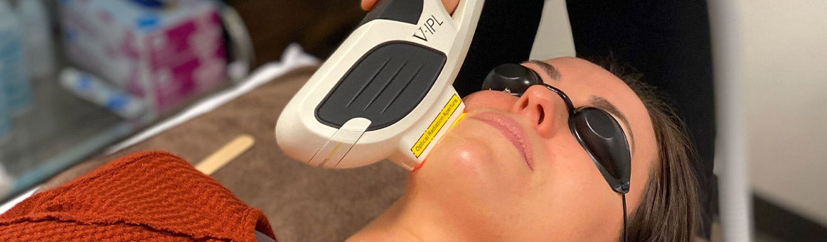 IPL Photofacial