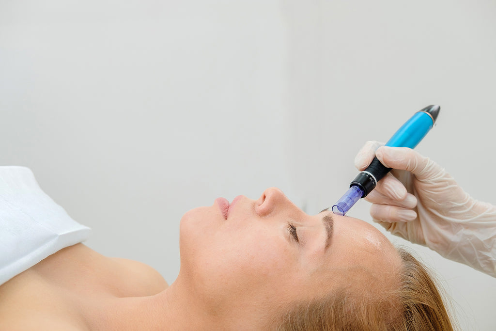 Microneedling Treatment